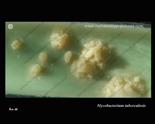mycobacterium tuberculosis culture close-up